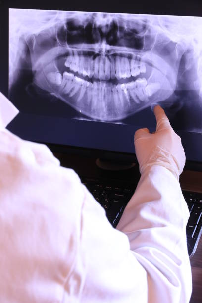 Best Emergency Broken Tooth Repair in Preston, IA