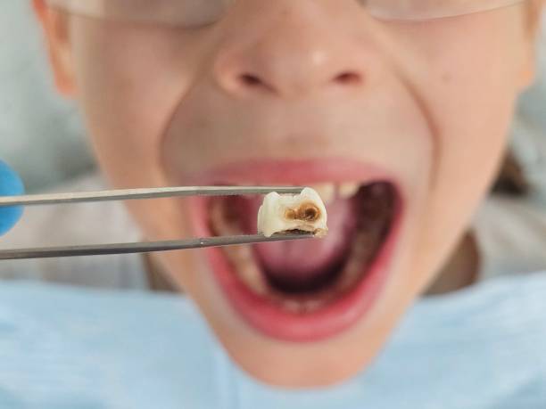 Best After-Hours Emergency Dentist in Preston, IA